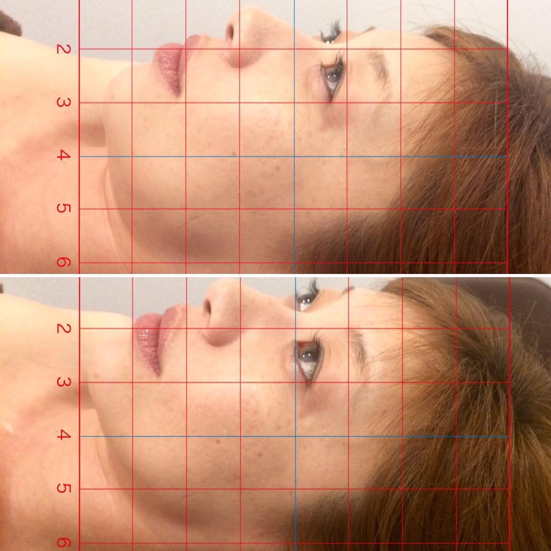 今日はお顔のBefore Afterです✨